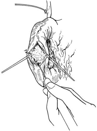 pagenumber_ebook=443,pagenumber_book=428