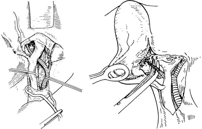 pagenumber_ebook=577,pagenumber_book=562