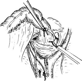 pagenumber_ebook=425,pagenumber_book=410