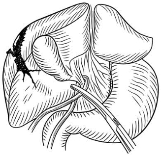 pagenumber_ebook=574,pagenumber_book=559