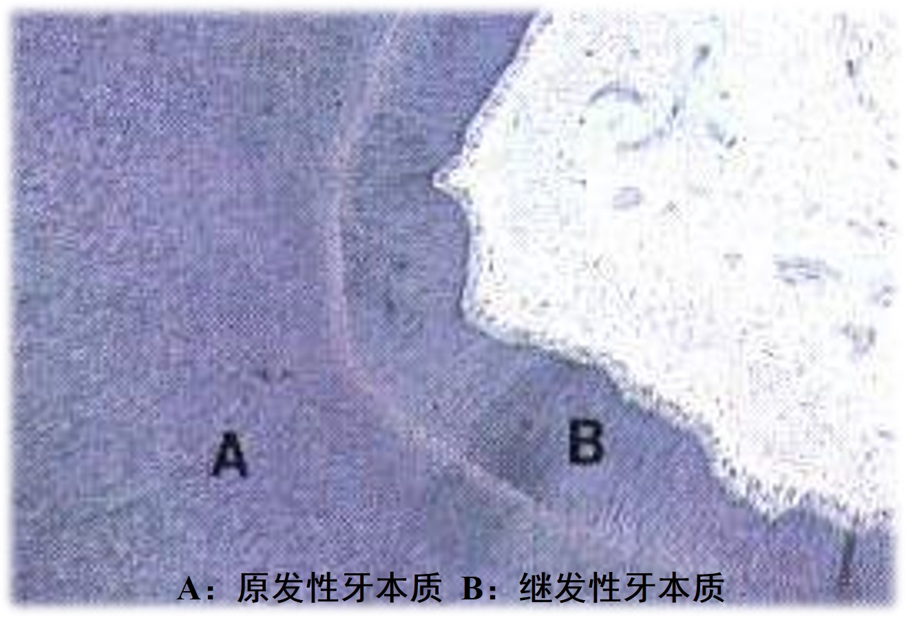 3.2-9 原发和继发性牙本质.jpg