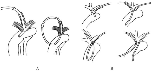 pagenumber_ebook=145,pagenumber_book=130
