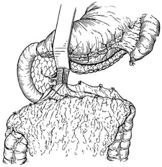 pagenumber_ebook=384,pagenumber_book=369