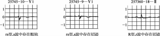 pagenumber_ebook=92,pagenumber_book=83