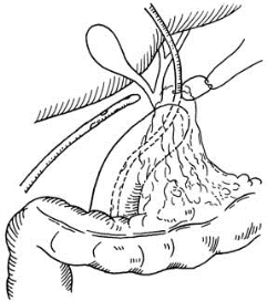 pagenumber_ebook=153,pagenumber_book=138