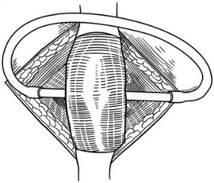 pagenumber_ebook=569,pagenumber_book=554