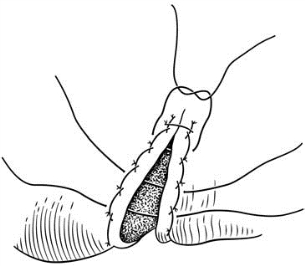 pagenumber_ebook=575,pagenumber_book=560