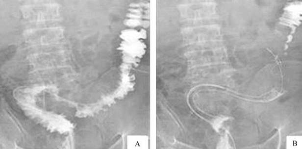 pagenumber_ebook=295,pagenumber_book=280