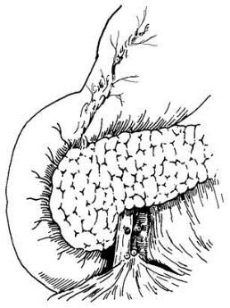 pagenumber_ebook=360,pagenumber_book=345