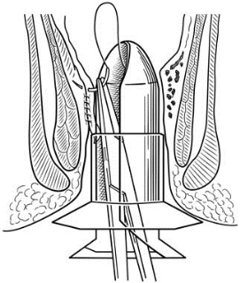 pagenumber_ebook=609,pagenumber_book=594