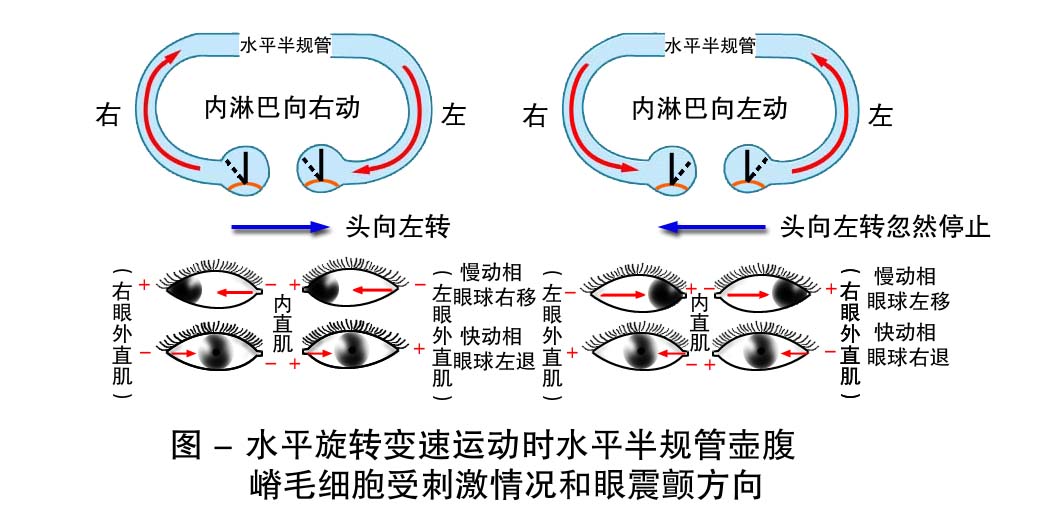 25-水平旋转变速运动时毛细胞受刺激情况和眼震颤方向.jpg