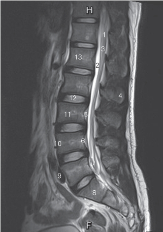 pagenumber_ebook=33,pagenumber_book=24