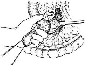 pagenumber_ebook=495,pagenumber_book=480