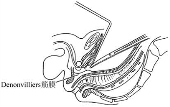 pagenumber_ebook=209,pagenumber_book=194