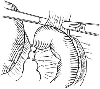 pagenumber_ebook=514,pagenumber_book=499