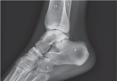 pagenumber_ebook=169,pagenumber_book=160