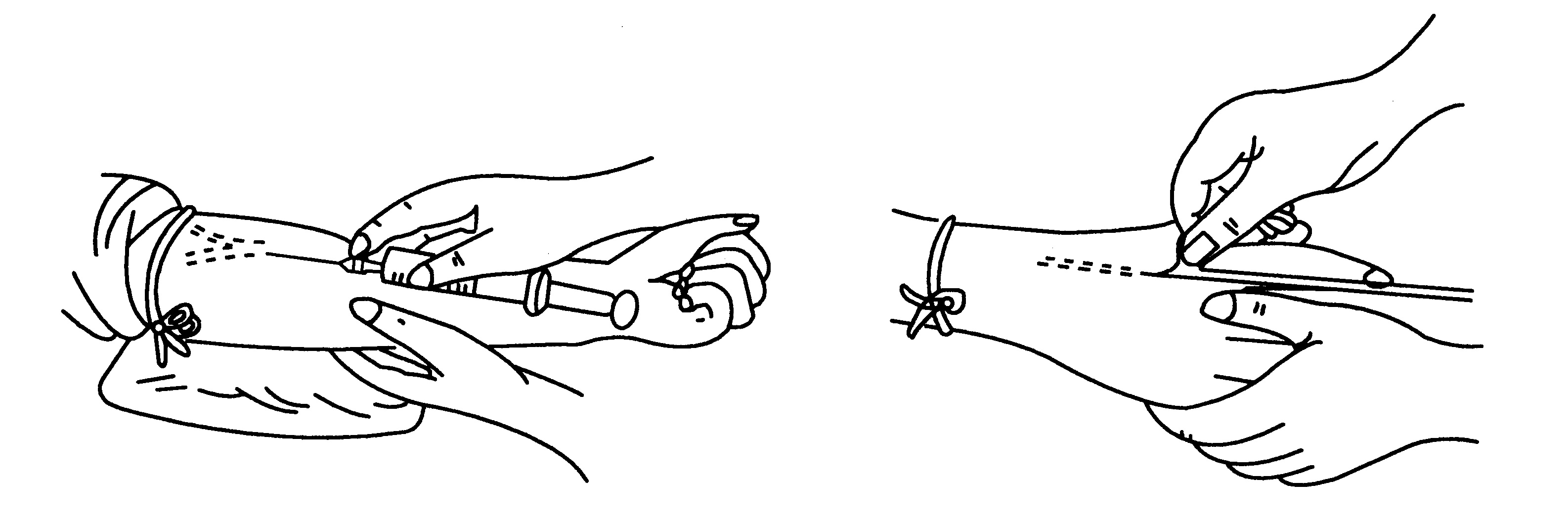 静脉注射进针法