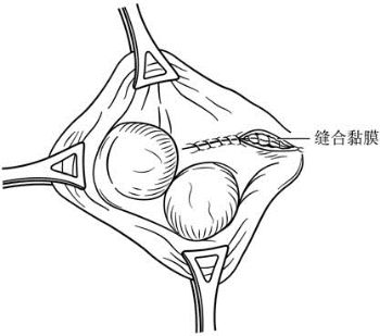 pagenumber_ebook=601,pagenumber_book=586