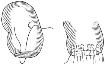 pagenumber_ebook=234,pagenumber_book=219