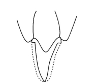 pagenumber_ebook=245,pagenumber_book=236