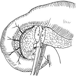 pagenumber_ebook=532,pagenumber_book=517