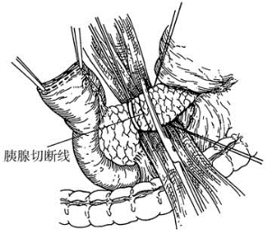 pagenumber_ebook=493,pagenumber_book=478