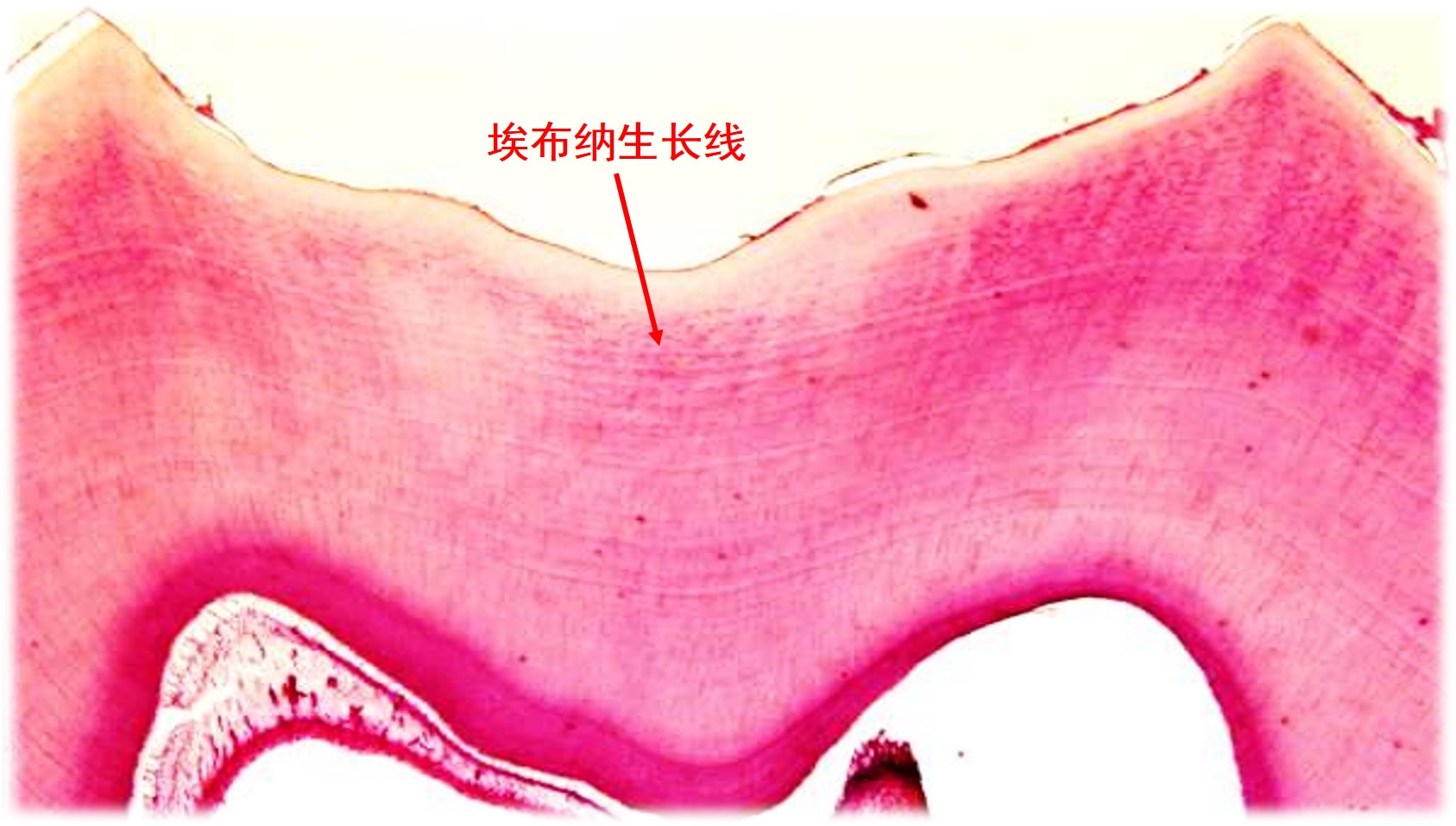 3.2-6 牙本质生长线.jpg