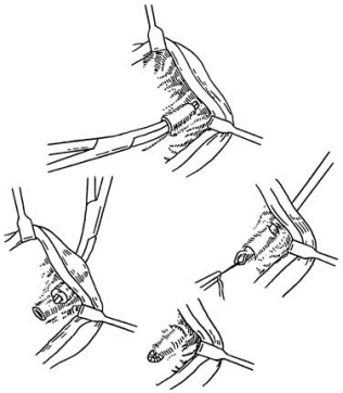 pagenumber_ebook=242,pagenumber_book=227