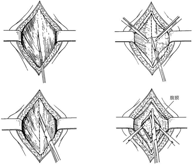 pagenumber_ebook=544,pagenumber_book=529