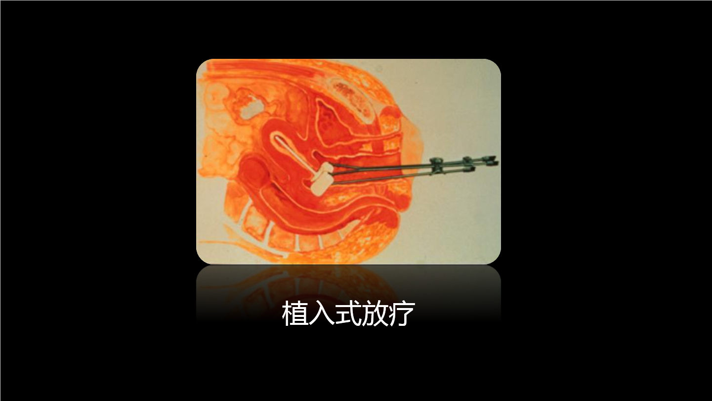 空间分离:.png