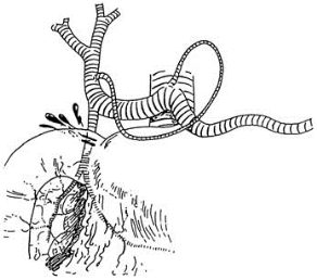 pagenumber_ebook=108,pagenumber_book=93