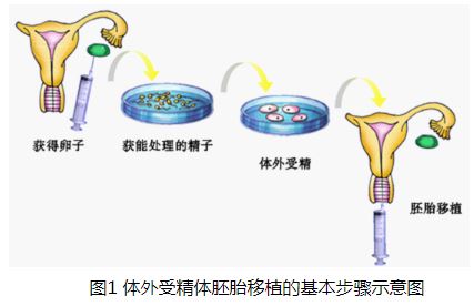 人类辅助生殖技术1.JPG