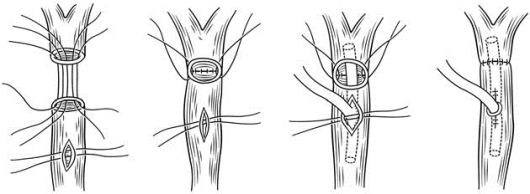 pagenumber_ebook=231,pagenumber_book=216