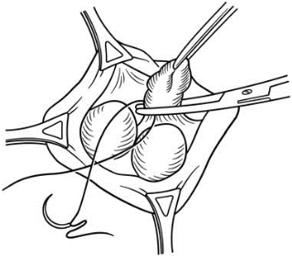 pagenumber_ebook=601,pagenumber_book=586