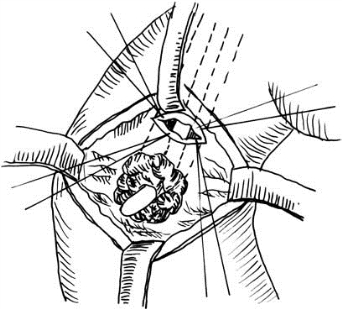 pagenumber_ebook=537,pagenumber_book=522