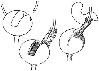 pagenumber_ebook=242,pagenumber_book=227