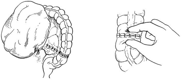 pagenumber_ebook=393,pagenumber_book=378