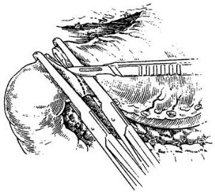 pagenumber_ebook=325,pagenumber_book=310