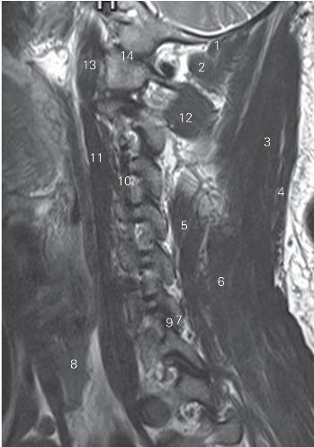 pagenumber_ebook=15,pagenumber_book=6