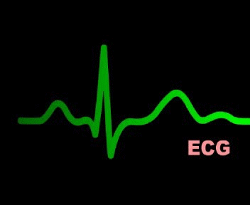 心电图.gif