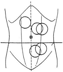 pagenumber_ebook=171,pagenumber_book=156