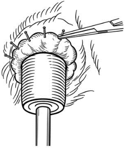 pagenumber_ebook=607,pagenumber_book=592