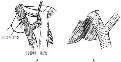 pagenumber_ebook=471,pagenumber_book=456