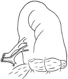 pagenumber_ebook=512,pagenumber_book=497