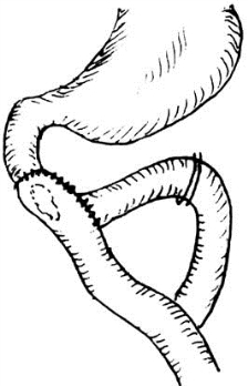 pagenumber_ebook=566,pagenumber_book=551