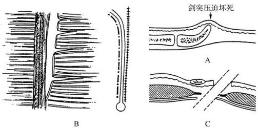 pagenumber_ebook=79,pagenumber_book=64