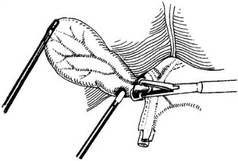 pagenumber_ebook=457,pagenumber_book=442