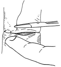 pagenumber_ebook=99,pagenumber_book=84