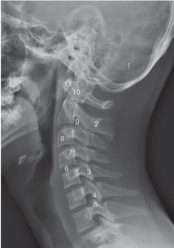 pagenumber_ebook=157,pagenumber_book=148