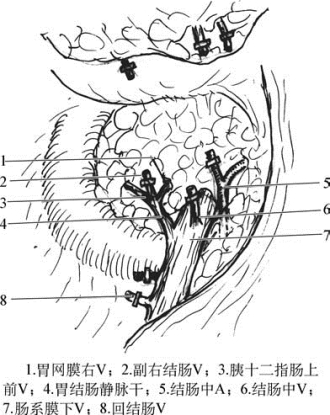 pagenumber_ebook=398,pagenumber_book=383